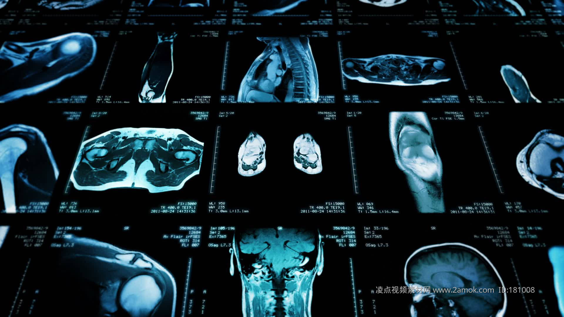 CCD視覺檢測設(shè)備在醫(yī)療影像分析中的應(yīng)用